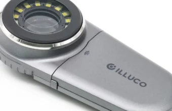 A handheld dermatoscope on a white background representing skin examination technology