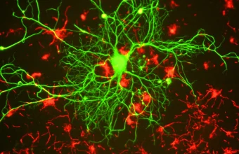 Fluorescence microscopy image of a single neuron with green dendrites branching outward against a dark background