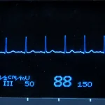 A heart monitor screen showing a steady blue heartbeat trace with evenly spaced peaks and a heart rate of 88